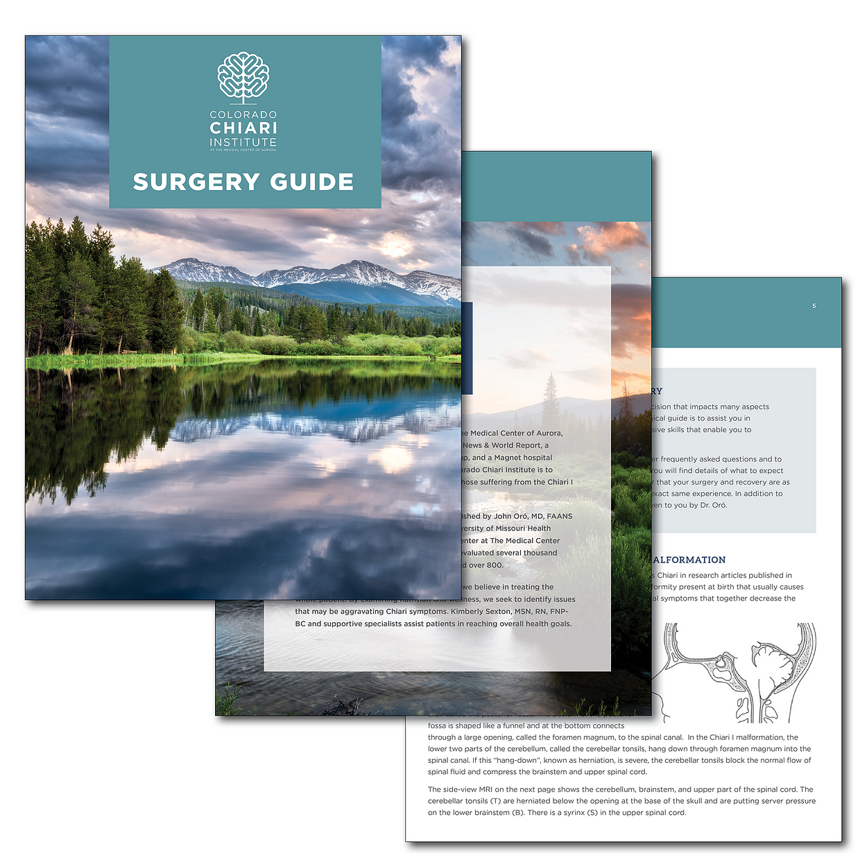 Patient Surgery Guide